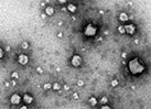 Liposomal Nano-encapsulation