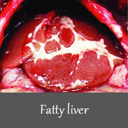 fatty-liver-1