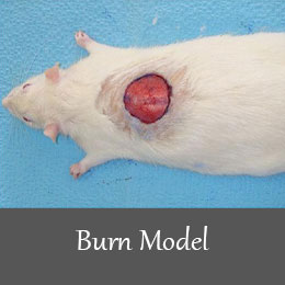 Burn-model-1