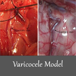 varicocele-model