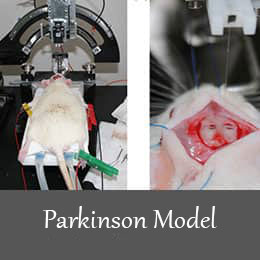parkinson-model.jpg