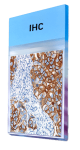 Immunohistochemistry-IHC