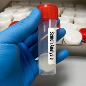 Sperm analysis